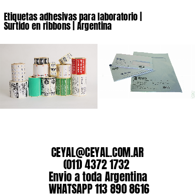 Etiquetas adhesivas para laboratorio | Surtido en ribbons | Argentina